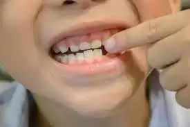 छोटे बच्चों के लिए दांतों और मसूड़ों की देखभाल भी जरूरी